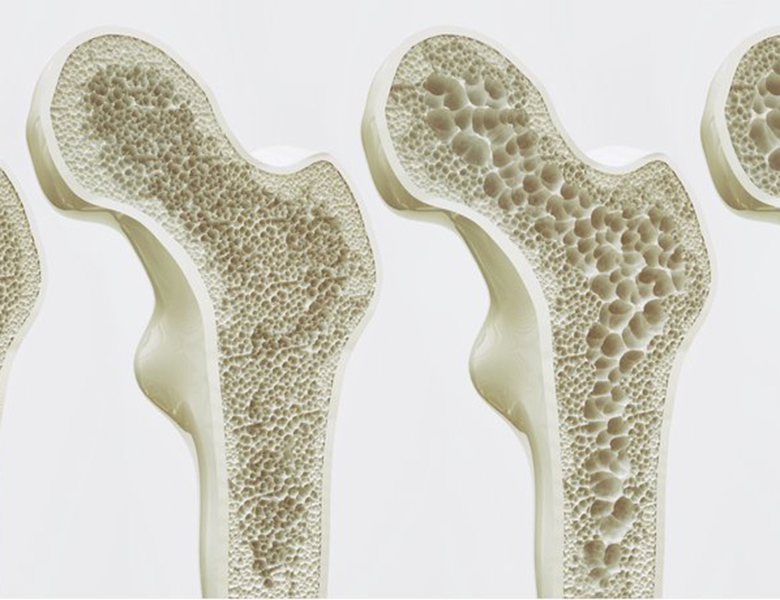 山口県柳井市の歯医者の歯医者、いそべ歯科医院で、インプラント治療